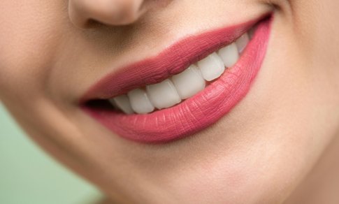 Periodontitas – klastinga liga, kuria serga daugelis: išduoda kraujuojančios dantenos ir „pailgėję“ dantys